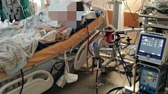 В Твери врачи спасли 16-летнюю девушку с критическим поражением легких