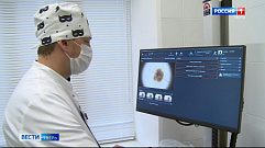 Новый аппарат для ранней диагностики рака кожи появился в центра имени Аваева в Твери 